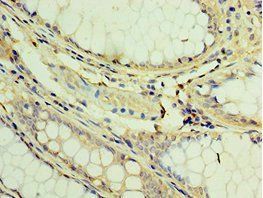 TGS1 Antibody