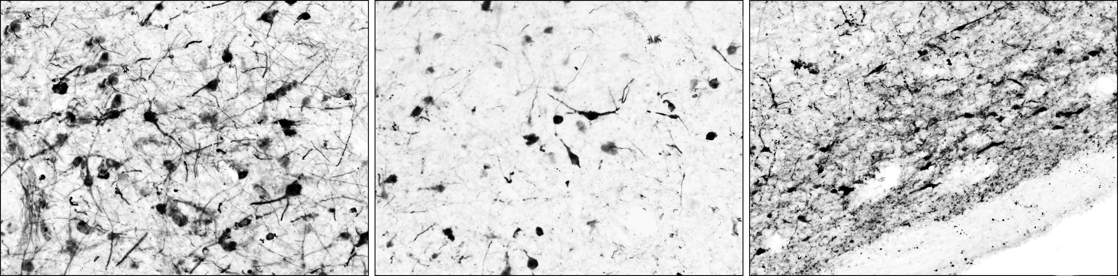 Goat anti-Tyrosine Hydroxylase Antibody