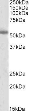 Goat anti-Tyrosine Hydroxylase Antibody