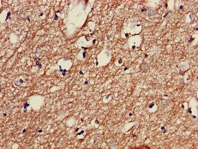 TH Antibody