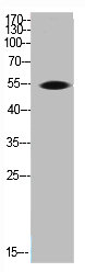 TH Antibody