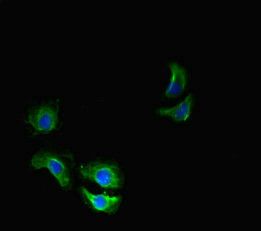 THADA Antibody