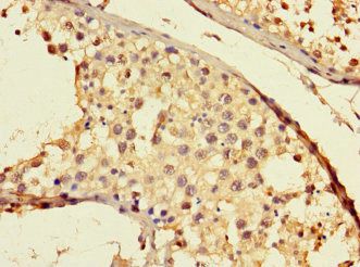 THADA Antibody