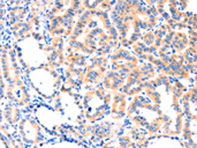 THBS1 Antibody