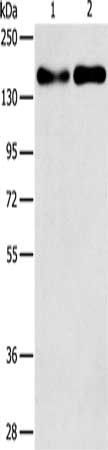 THBS1 antibody