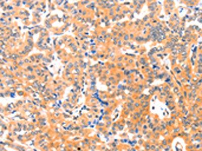 THBS1 Antibody