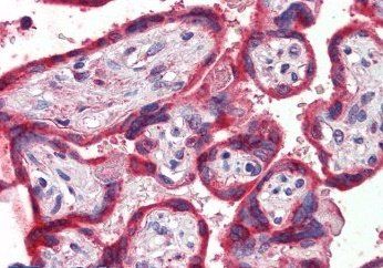Goat anti-Thrombospondin Antibody