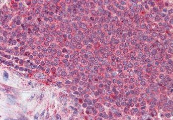 Goat anti-Thrombospondin Antibody