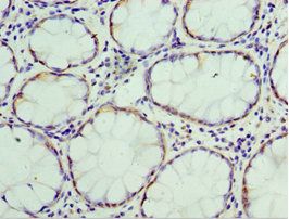 THBS3 Antibody