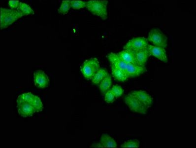 THEMIS Antibody