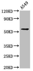 THEMIS2 Antibody