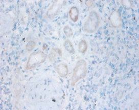 TPMT Antibody