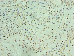 THOC1 antibody