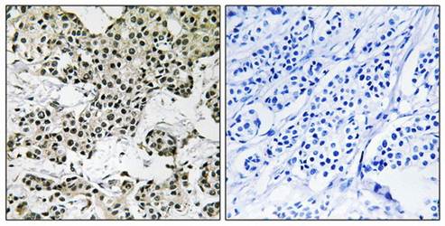THOC5 Antibody