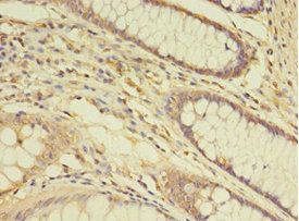 THRA Antibody