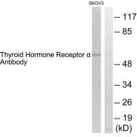 THRA antibody