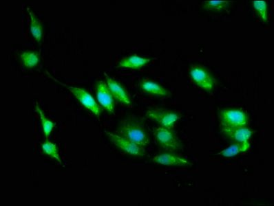 threonine-protein kinase 24 antibody