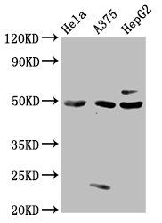 threonine-protein kinase 24 antibody