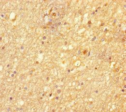 NIM1K Antibody