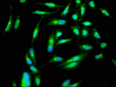 threonine-protein kinase PAK 4 antibody