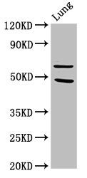 threonine-protein kinase PAK 4 antibody