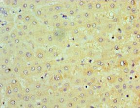 threonine-protein kinase TBK1 antibody