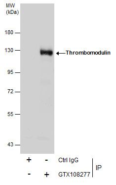 Thrombomodulin antibody