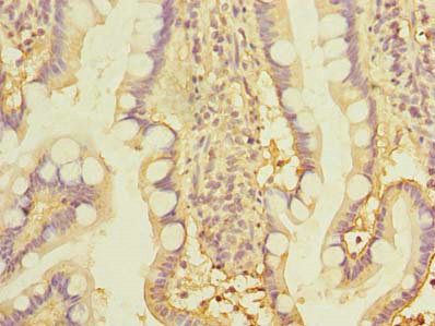 THTPA Antibody