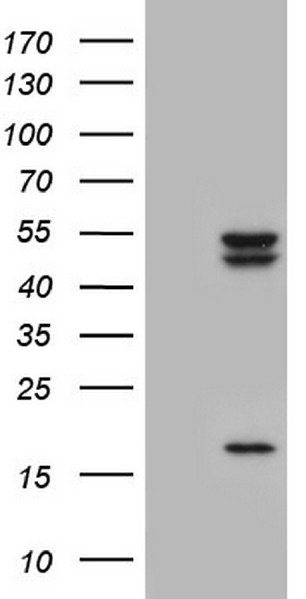 TYMP Antibody