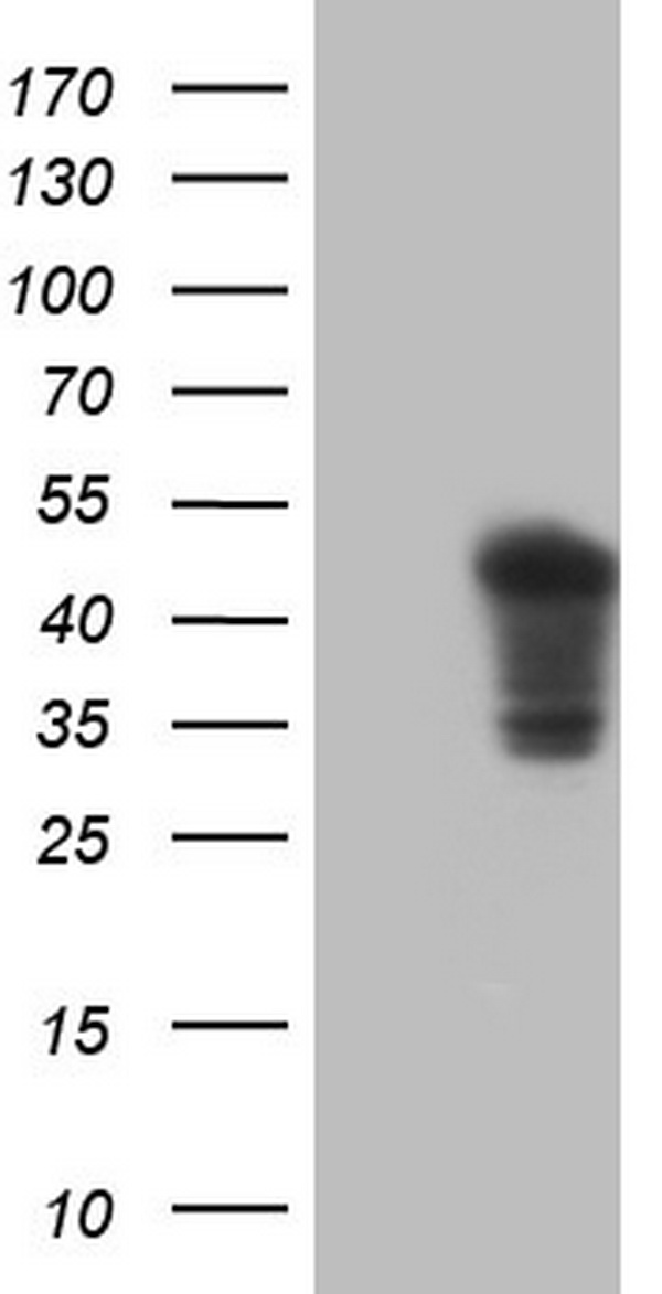 Thymidylate Synthase Antibody