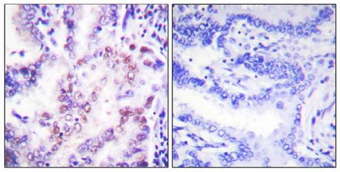 Thyroid Hormone Receptor β Antibody