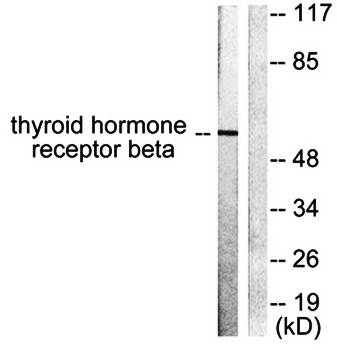 Thyroid Hormone Receptor β Antibody