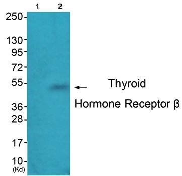 Thyroid Hormone Receptor β Antibody