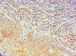 TIA1 antibody