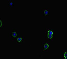 TIAM1 Antibody