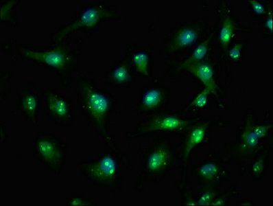 TIAM2 Antibody