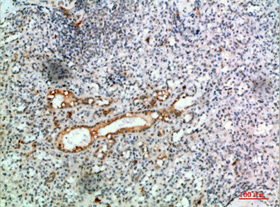TICAM1 Antibody