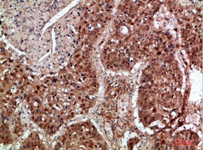 TICAM1 Antibody