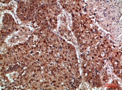 TICAM1 Antibody