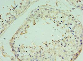 TICAM2 Antibody