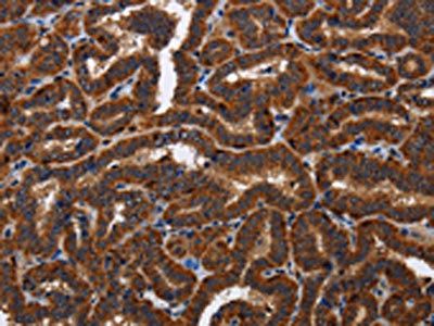 TICAM2 Antibody