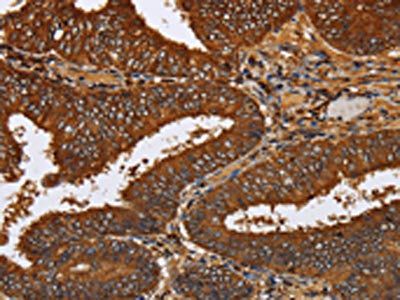 TICAM2 Antibody