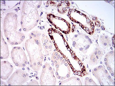 TIE1 Antibody