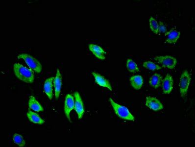 TIE1 antibody