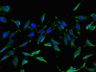 TIGAR antibody