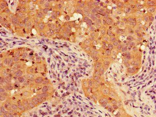 TIGAR Antibody