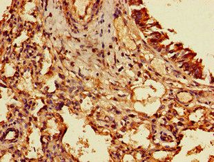 TIGAR Antibody