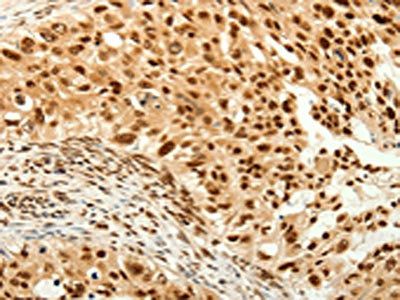 TIGAR Antibody