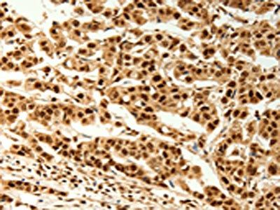 TIGAR antibody