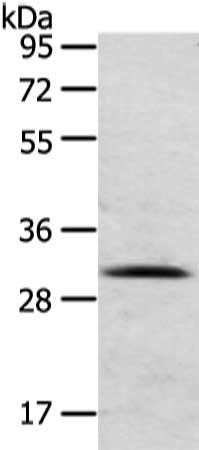 TIGAR antibody